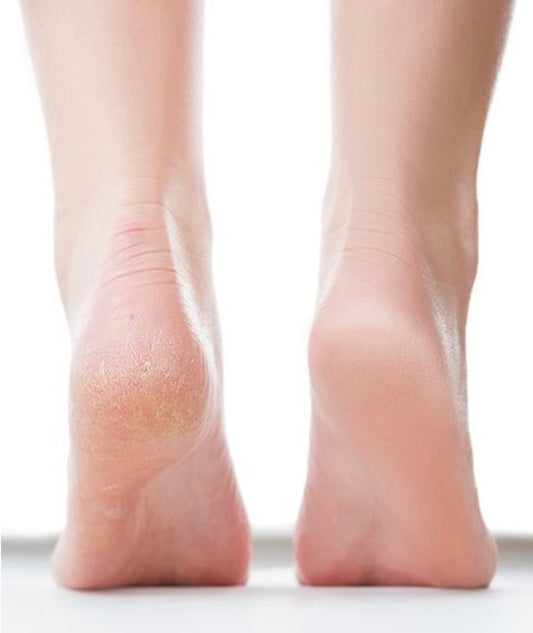 OPI FEET CALLUS THERAPY